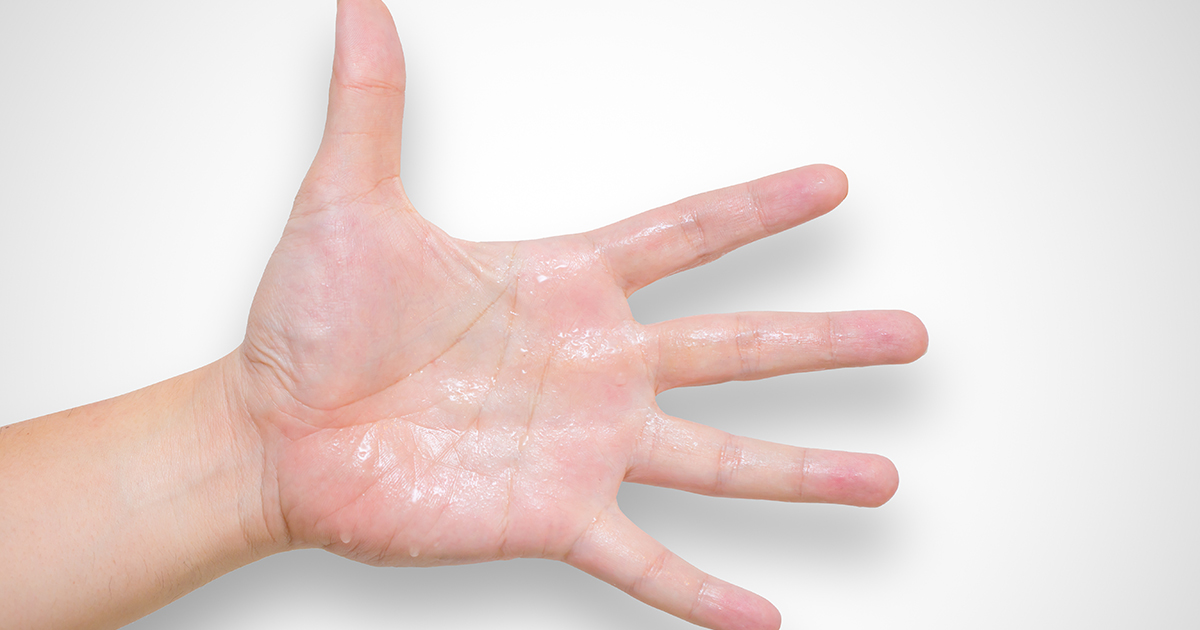 5 кроків, які дозволять уникнути ефекту спітнілих рук  