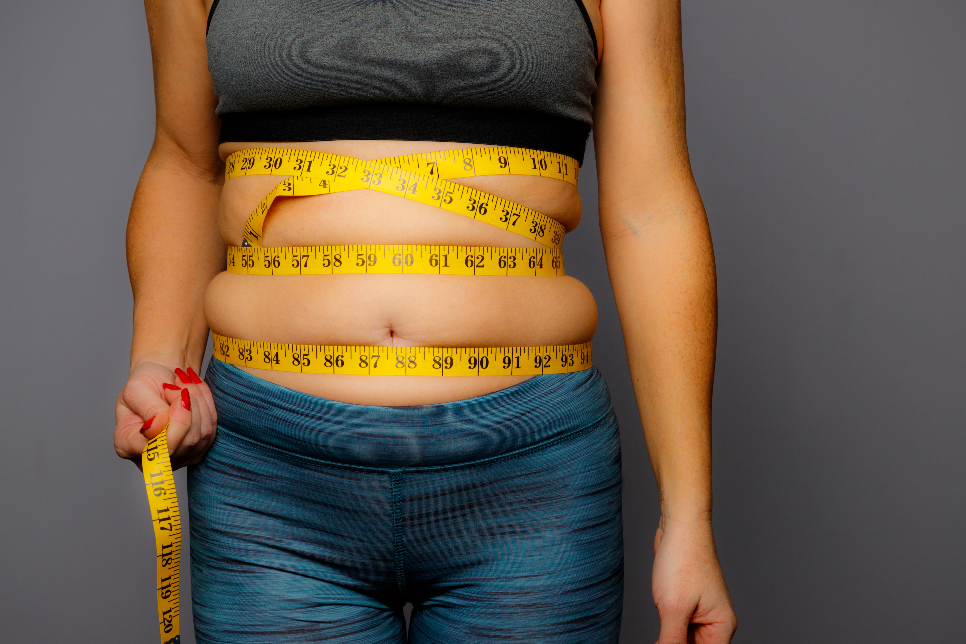 Не всі ожиріння однакові: дослідники пояснили типи і наслідки зайвої ваги  